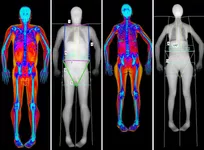 Bespreken van lichaamssamenstelling met DXA-scanrapport, image credits: https://qims.amegroups.com/article/view/41830/html